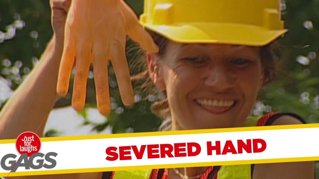 Severed Hand